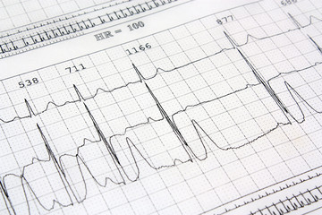 Electrocardiogram ekg heart