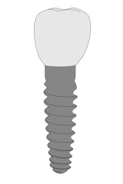 cartoon image of tooth implant