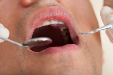 Obraz premium Man Going Through Dental Examination In Clinic