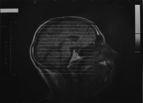 Röntgenbild Kopf