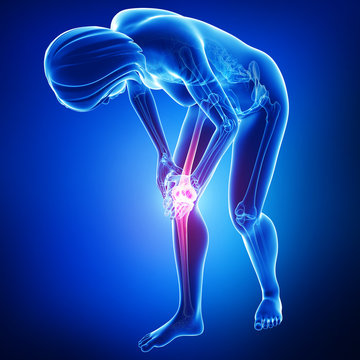 Female knee pain anatomy on blue