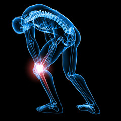 Male knee pain anatomy on black