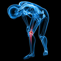 Female knee pain anatomy on black