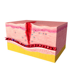 3d Anatomy of  tissue repair in human skin