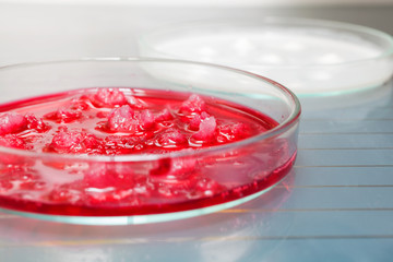 Growing Bacteria in Petri Dishes