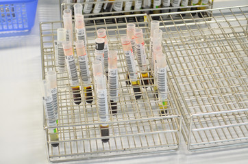 tubes prepared in lab centrifuge machine blood bank..