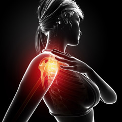 Anatomy of shoulder pain in black