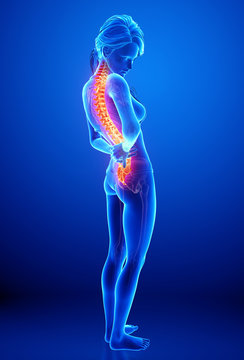 3d Anatomy of female back pain