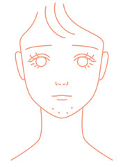 あごニキビに悩やむ女の子