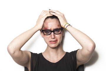 Beaten up girl wearing glasses and crying