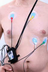 tragbares ambulantes EKG an Patienten