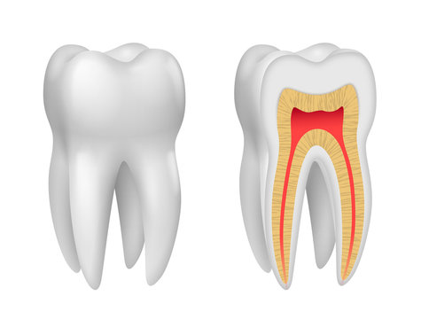 Dents vectorielles 2