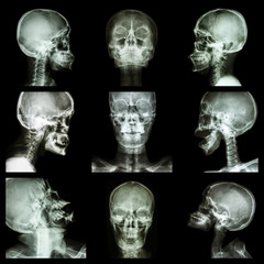 Collection of asian skull