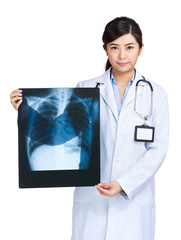 Female doctor holding x-ray film