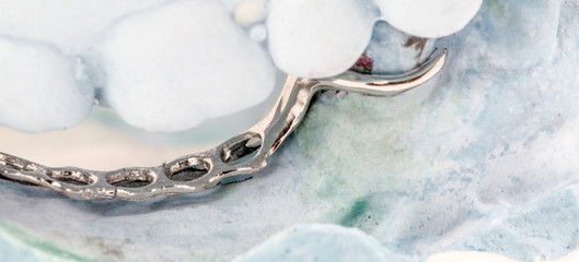 partial denture on a plaster mold