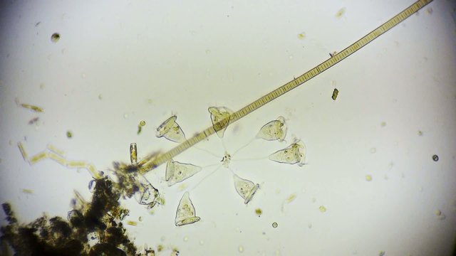 Vorticella - Glockentierchen unter dem Mikroskop in FullHD