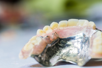 old partial denture © bunwit