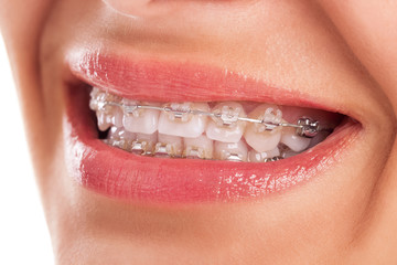 Fototapeta premium Perfect teeth