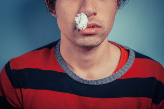Man with nose bleed and cold sores