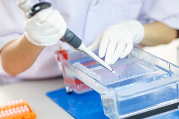 Loading samples into  gel for electrophoresis - 64306362