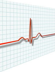 Cardiac complex on ECG