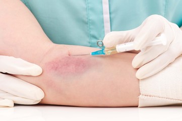 Painful injection