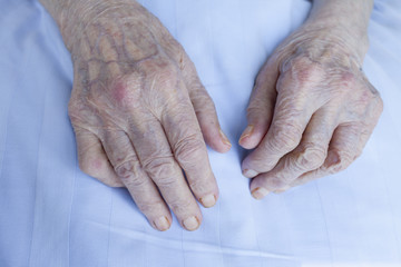Old wrinkle hands of 93 years old lady