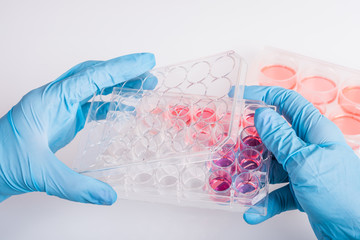 Human cell into biomedical scientific laboratory.