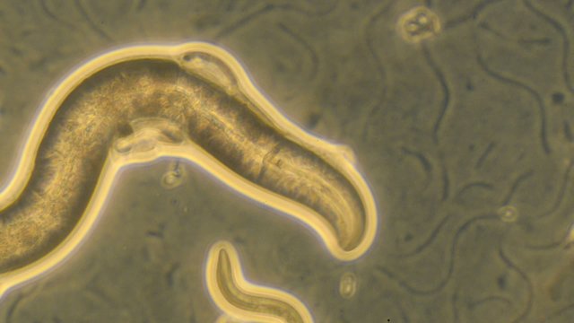 Caenorhabditis elegans, a free-living transparent nematode