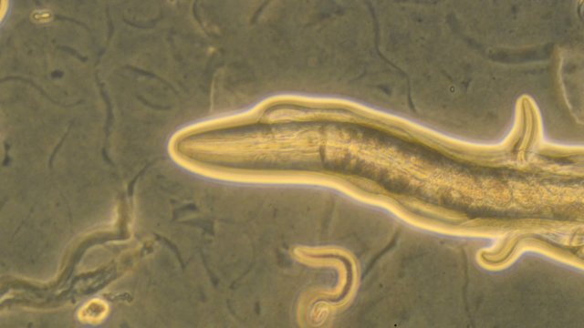 Caenorhabditis elegans, a free-living transparent nematode
