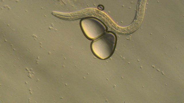 Caenorhabditis elegans, a free-living transparent nematode
