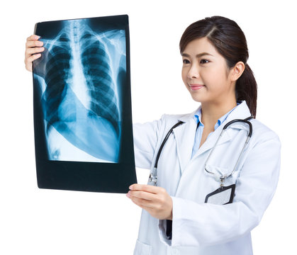Woman doctor looking at x ray