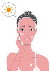 日焼け、皮が剥ける