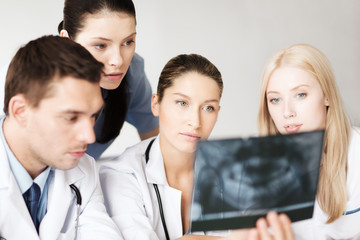 Fototapeta premium group of doctors looking at x-ray