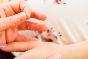 Hebamme gibt Schwangeren Akupunktur 