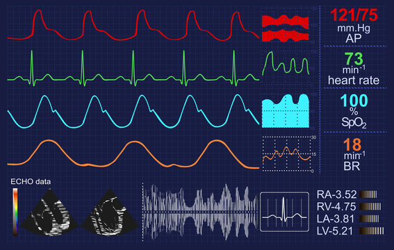 Heartbeat Monitor With Lots Of Curves And Other Data