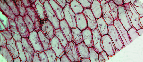 Onion epidermus micrograph