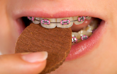 Pink braces
