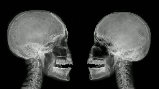 Two arguing skulls.