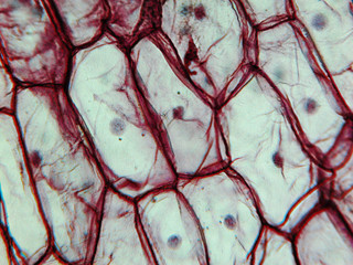 Onion epidermus micrograph