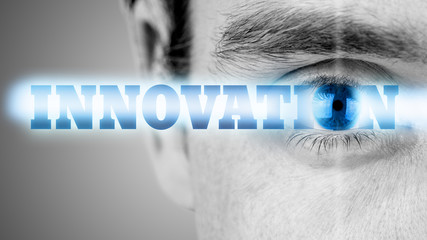 Innovation