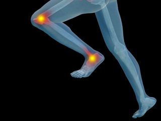Obraz premium Conceptual human pain anatomy
