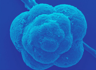 раковина планктонного организма