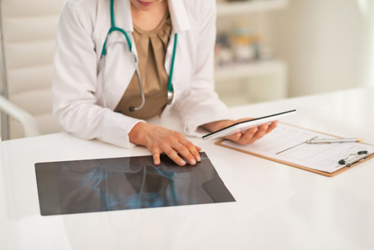Closeup on doctor woman with fluorography using tablet pc