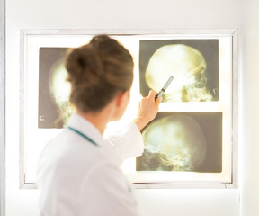 Medical doctor woman pointing on tomography. rear view