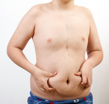 young man with obesity shows fat on his belly