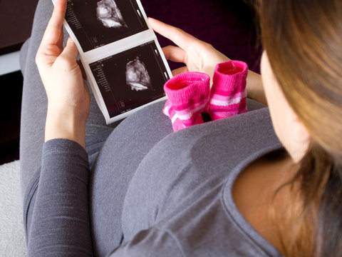 Pregnant woman and ultrasound image of baby
