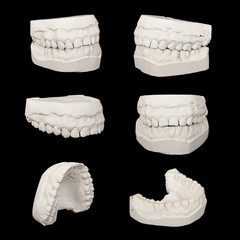 Set of Dental casting gypsum models plaster cast
