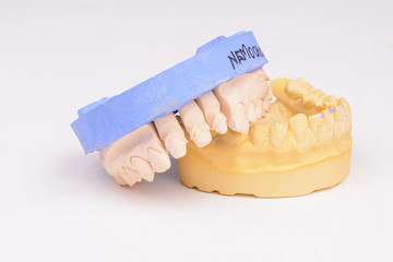 Teeth model