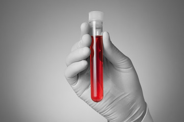 Doctor's hand with blood sample